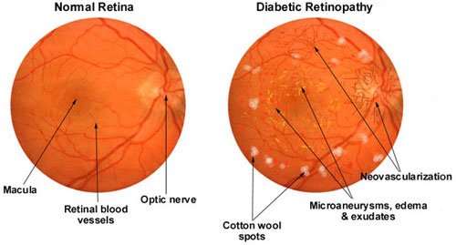 diagnosis diagnosis